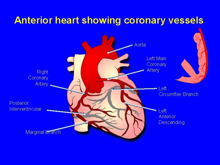 Anterior heart showing coronary vessels Aorta Right Coronary Artery Posterior Interventricular Marginal Branch Left