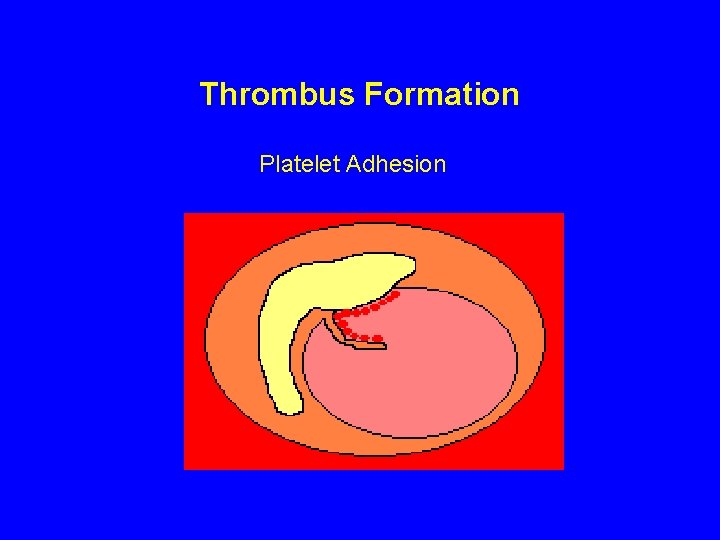 Thrombus Formation Platelet Adhesion 