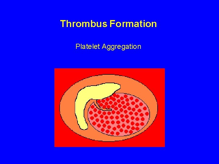 Thrombus Formation Platelet Aggregation 