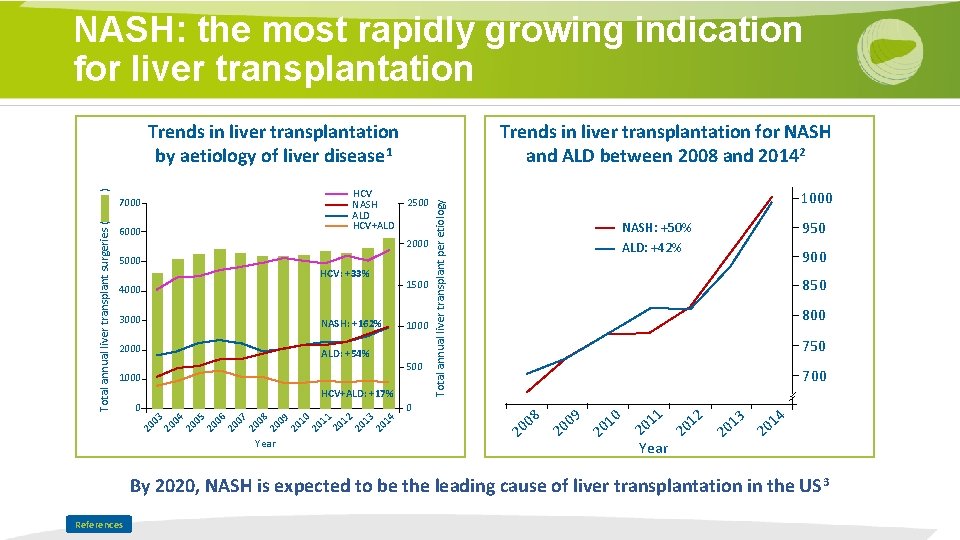 NASH: the most rapidly growing indication for liver transplantation Trends in liver transplantation for