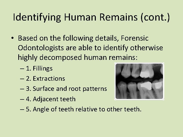 Identifying Human Remains (cont. ) • Based on the following details, Forensic Odontologists are Identifying Human Remains (cont. ) • Based on the following details, Forensic Odontologists are