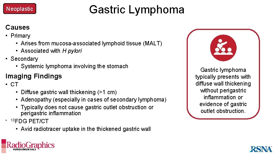 Neoplastic Gastric Lymphoma Causes • Primary • Arises from mucosa-associated lymphoid tissue (MALT) •