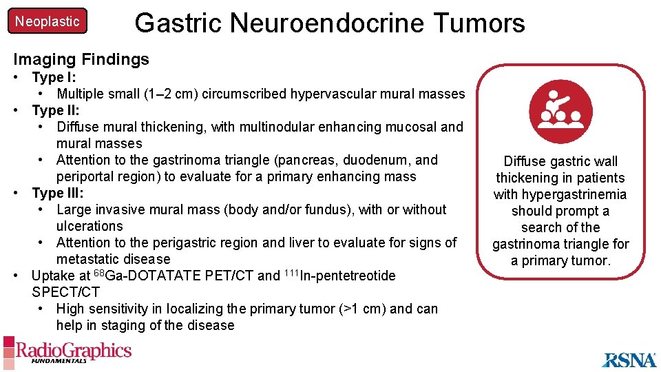 Neoplastic Gastric Neuroendocrine Tumors Imaging Findings • Type I: • Multiple small (1– 2