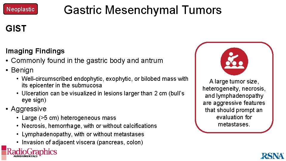 Neoplastic Gastric Mesenchymal Tumors GIST Imaging Findings • Commonly found in the gastric body