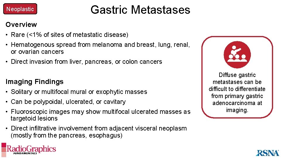 Neoplastic Gastric Metastases Overview • Rare (<1% of sites of metastatic disease) • Hematogenous