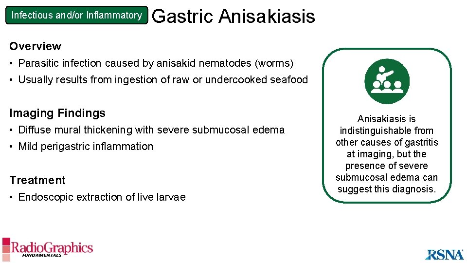 Infectious and/or Inflammatory Gastric Anisakiasis Overview • Parasitic infection caused by anisakid nematodes (worms)