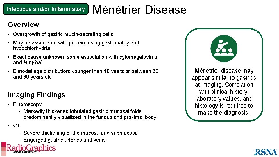 Infectious and/or Inflammatory Ménétrier Disease Overview • Overgrowth of gastric mucin-secreting cells • May