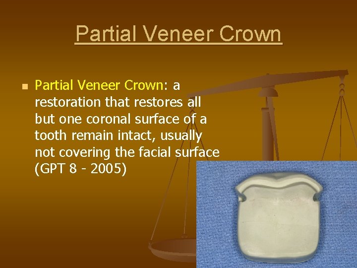 Partial Veneer Crown n Partial Veneer Crown: a restoration that restores all but one