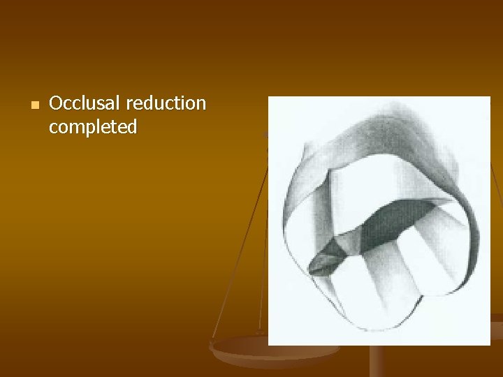 n Occlusal reduction completed 