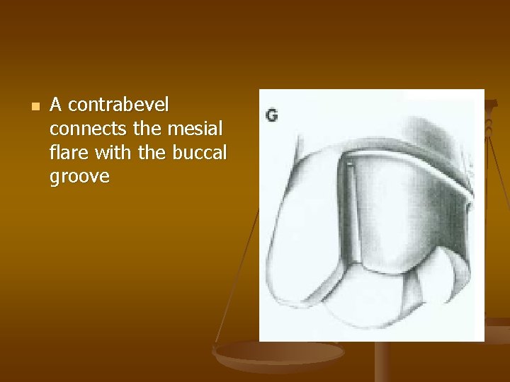 n A contrabevel connects the mesial flare with the buccal groove 