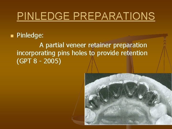 PINLEDGE PREPARATIONS n Pinledge: A partial veneer retainer preparation incorporating pins holes to provide