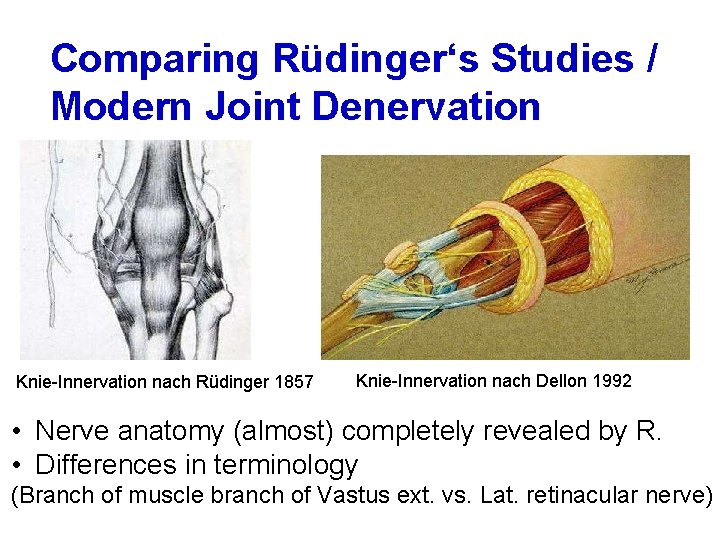 Comparing Rüdinger‘s Studies / Modern Joint Denervation Knie-Innervation nach Rüdinger 1857 Knie-Innervation nach Dellon