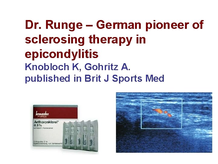 Dr. Runge – German pioneer of sclerosing therapy in epicondylitis Knobloch K, Gohritz A.