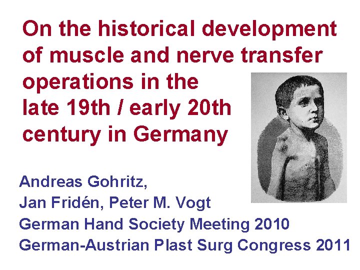 On the historical development of muscle and nerve transfer operations in the late 19