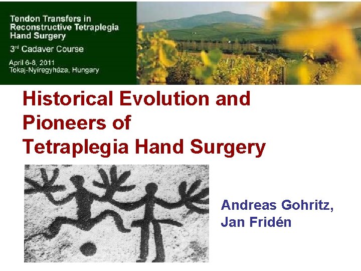 Historical Evolution and Pioneers of Tetraplegia Hand Surgery Andreas Gohritz, Jan Fridén 