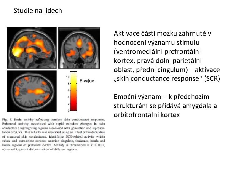 Studie na lidech Aktivace částí mozku zahrnuté v hodnocení významu stimulu (ventromediální prefrontální kortex,