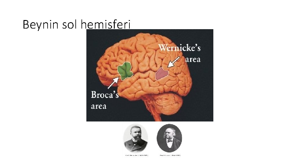 Beynin sol hemisferi 