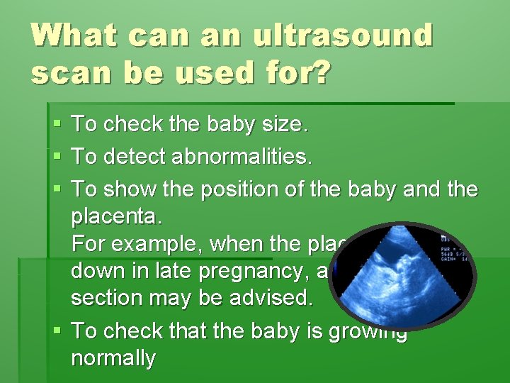 What can an ultrasound scan be used for? § § § To check the
