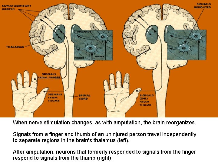 When nerve stimulation changes, as with amputation, the brain reorganizes. Signals from a finger