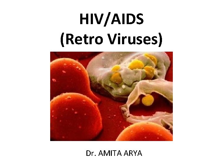 HIV/AIDS (Retro Viruses) Dr. AMITA ARYA 