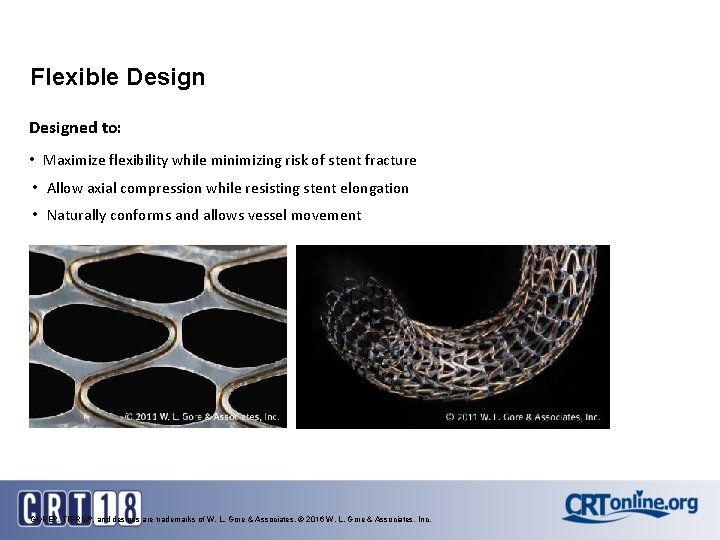 Flexible Designed to: • Maximize flexibility while minimizing risk of stent fracture • Allow Flexible Designed to: • Maximize flexibility while minimizing risk of stent fracture • Allow