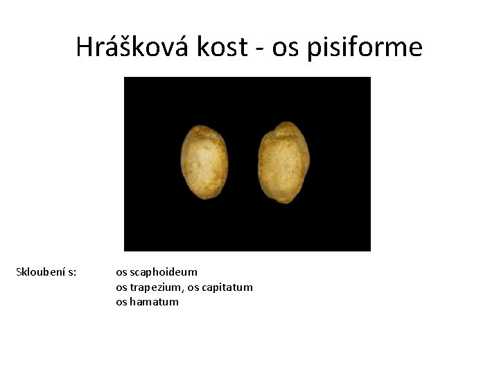 Hrášková kost - os pisiforme Skloubení s: os scaphoideum os trapezium, os capitatum os