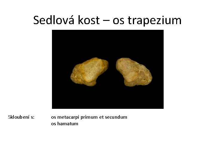 Sedlová kost – os trapezium Skloubení s: os metacarpi primum et secundum os hamatum