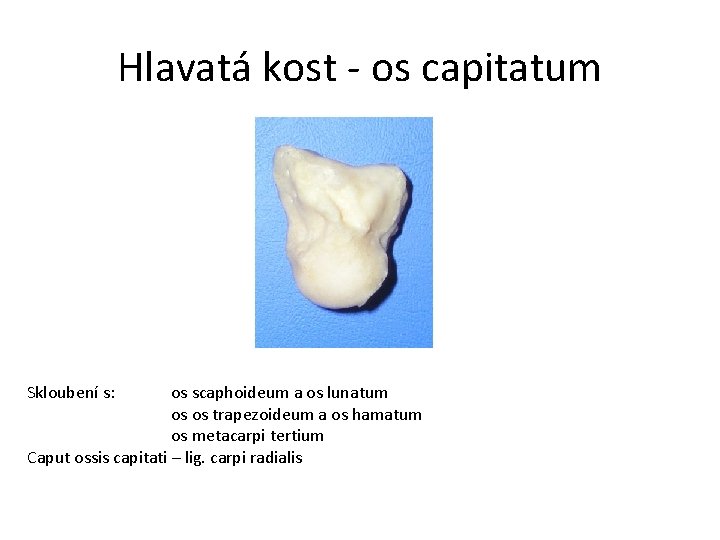 Hlavatá kost - os capitatum Skloubení s: os scaphoideum a os lunatum os os