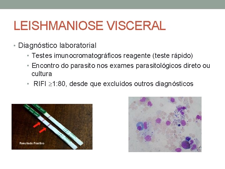 LEISHMANIOSE VISCERAL • Diagnóstico laboratorial • Testes imunocromatográficos reagente (teste rápido) • Encontro do