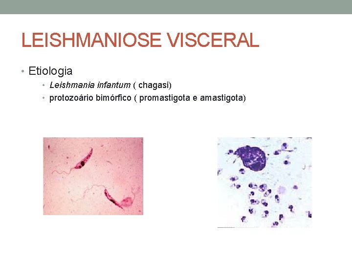 LEISHMANIOSE VISCERAL • Etiologia • Leishmania infantum ( chagasi) • protozoário bimórfico ( promastigota