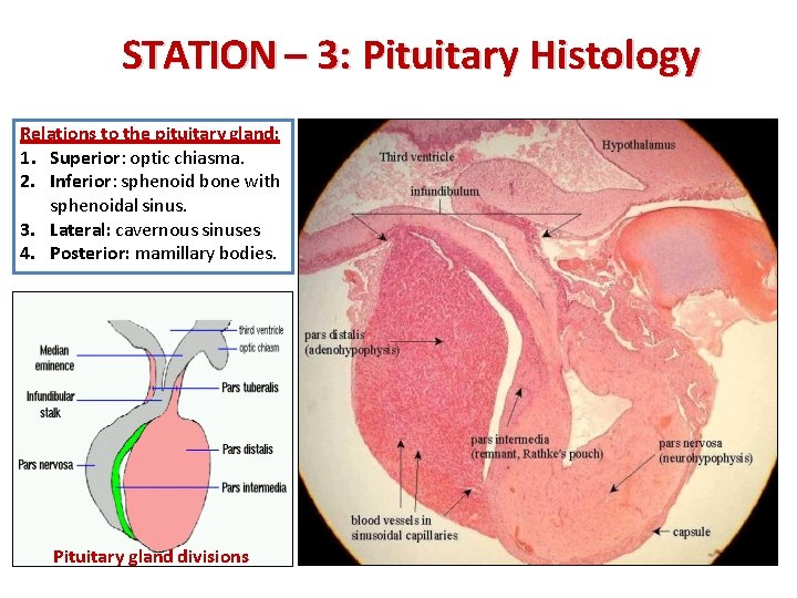STATION – 3: Pituitary Histology Relations to the pituitary gland: 1. Superior: optic chiasma.
