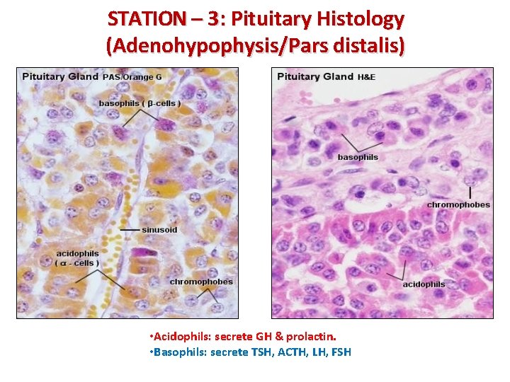 STATION – 3: Pituitary Histology (Adenohypophysis/Pars distalis) • Acidophils: secrete GH & prolactin. •