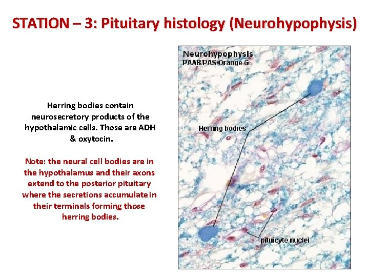 STATION – 3: Pituitary histology (Neurohypophysis) Herring bodies contain neurosecretory products of the hypothalamic