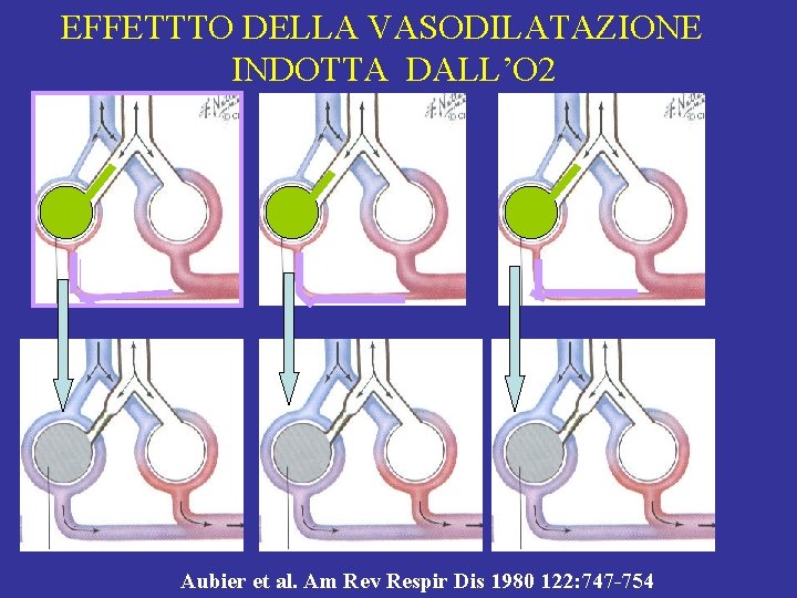 EFFETTTO DELLA VASODILATAZIONE INDOTTA DALL’O 2 Aubier et al. Am Rev Respir Dis 1980