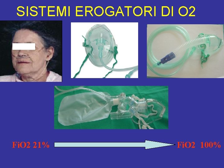 SISTEMI EROGATORI DI O 2 Fi. O 2 21% Fi. O 2 100% 