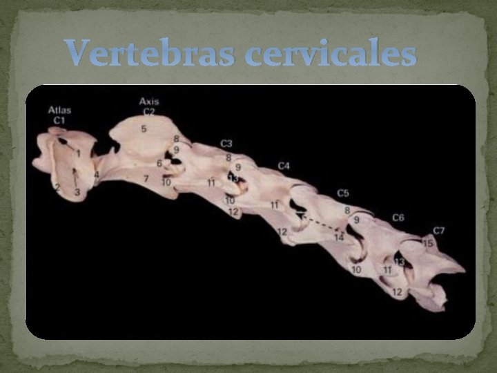 Vertebras cervicales 