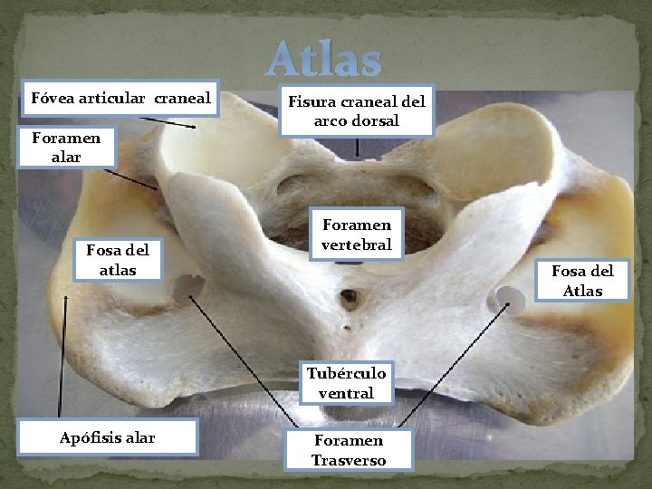 Atlas Fóvea articular craneal Foramen alar Fosa del atlas Fisura craneal del arco dorsal