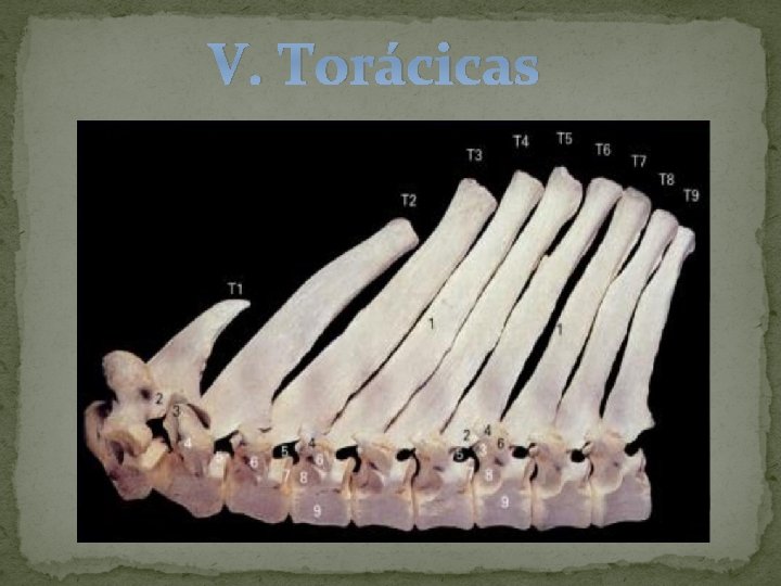 V. Torácicas 