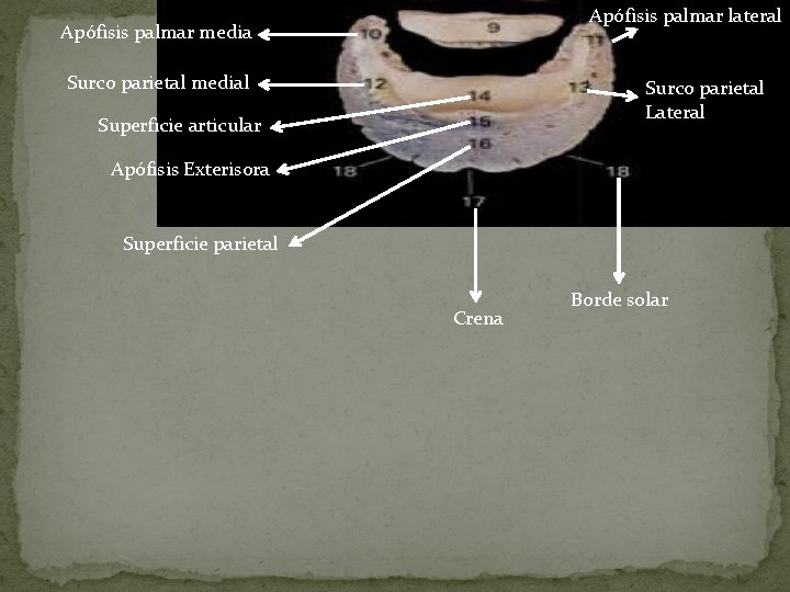 Apófisis palmar lateral Apófisis palmar media Surco parietal medial Surco parietal Lateral Superficie articular