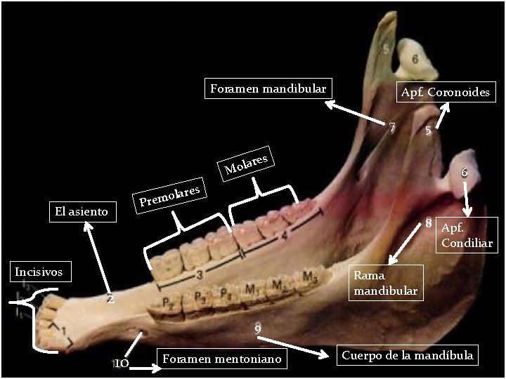 Foramen mandibular Apf. Coronoides 7 ares l o M lare o m e r