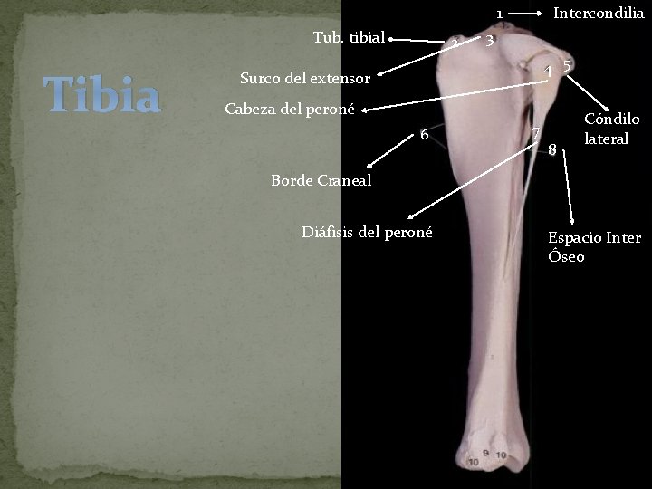 1 Tub. tibial Tibia 2 Intercondilia 3 4 5 Surco del extensor Cabeza del