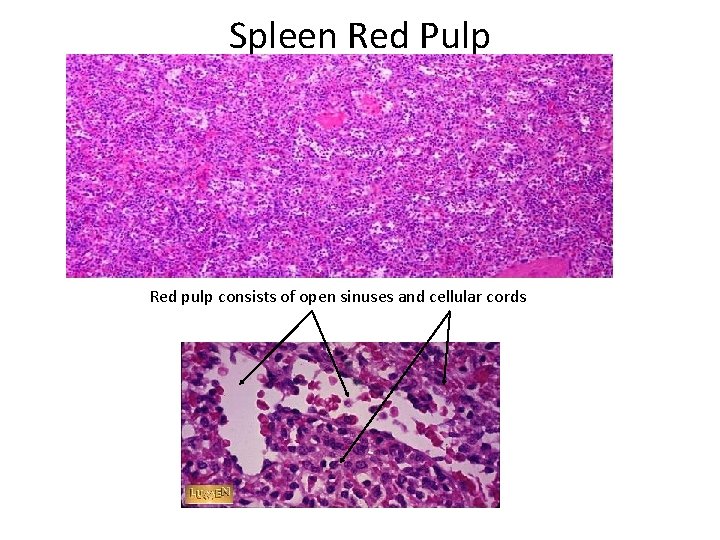 Spleen Red Pulp Red pulp consists of open sinuses and cellular cords 