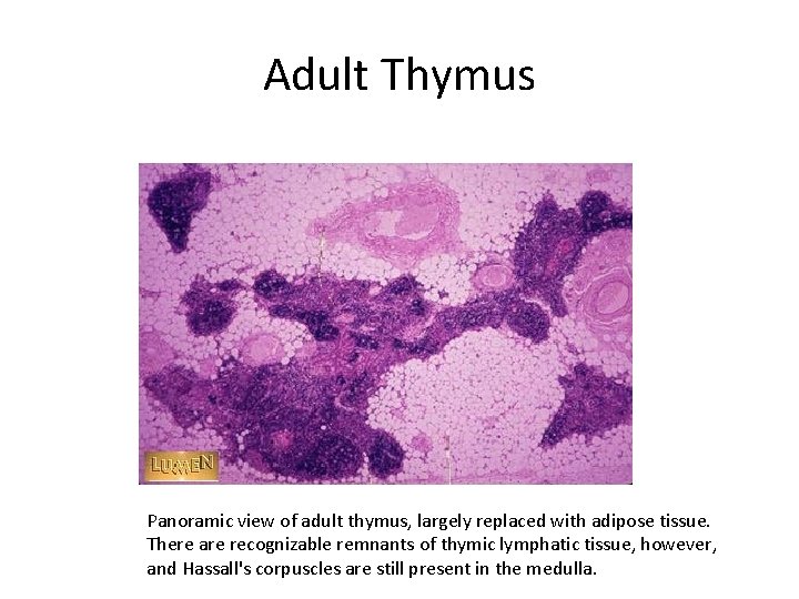 Adult Thymus Panoramic view of adult thymus, largely replaced with adipose tissue. There are