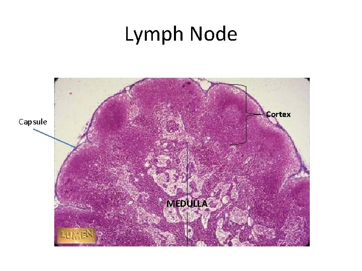 Lymph Node Cortex Capsule MEDULLA 