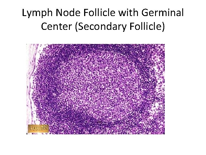 Lymph Node Follicle with Germinal Center (Secondary Follicle) 