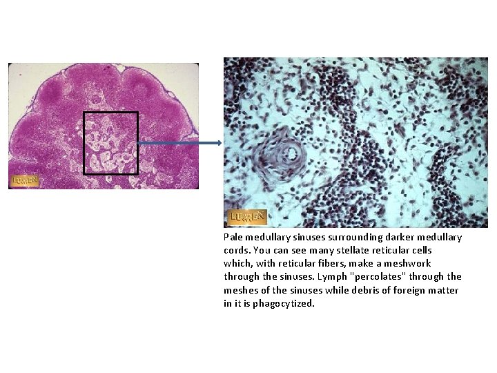 Pale medullary sinuses surrounding darker medullary cords. You can see many stellate reticular cells