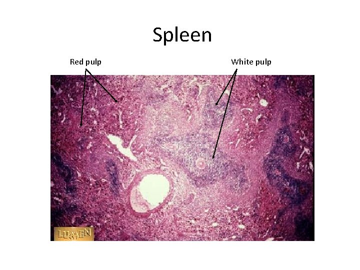 Spleen Red pulp White pulp 