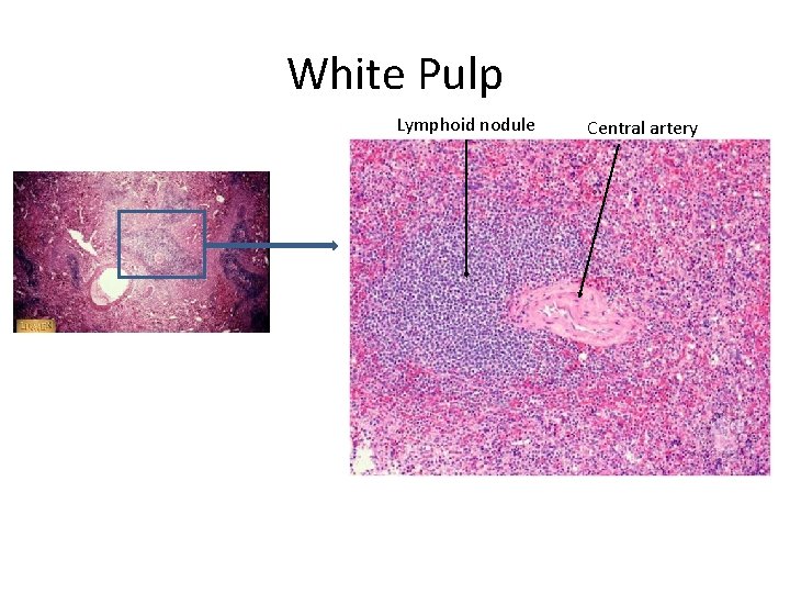 White Pulp Lymphoid nodule Central artery 