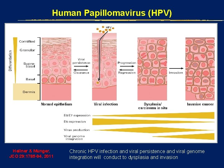 Human Papillomavirus (HPV) Hellner & Münger, JCO 29: 1785 -94, 2011 Chronic HPV infection