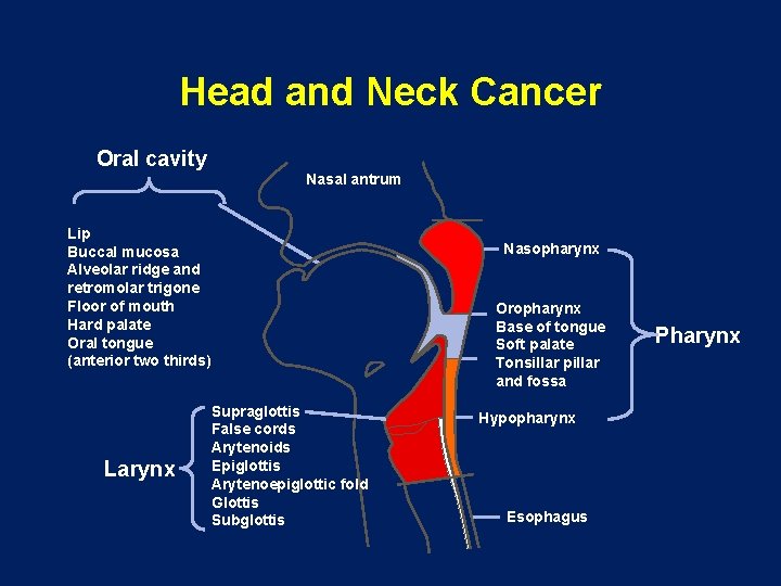 Head and Neck Cancer Oral cavity Nasal antrum Lip Buccal mucosa Alveolar ridge and
